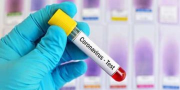 श्रीनगर में लगेगी हाईटेक टेस्टिंग मशीन